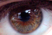 irisauge3