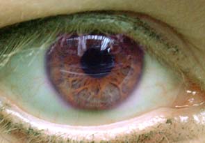 irisgreen