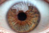 irisauge1