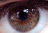 irisauge3